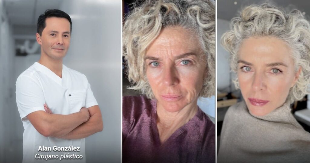 Un cirujano bogotano rejuveneció a Margarita Rosa de Francisco y que también a Miguel Varoni Un cirujano bogotano rejuveneció a Margarita Rosa de Francisco y que también a Miguel Varoni