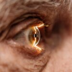Harvard prueba en humanos una técnica destinada a restaurar visión en personas con glaucoma Harvard prueba en humanos una técnica destinada a restaurar visión en personas con glaucoma