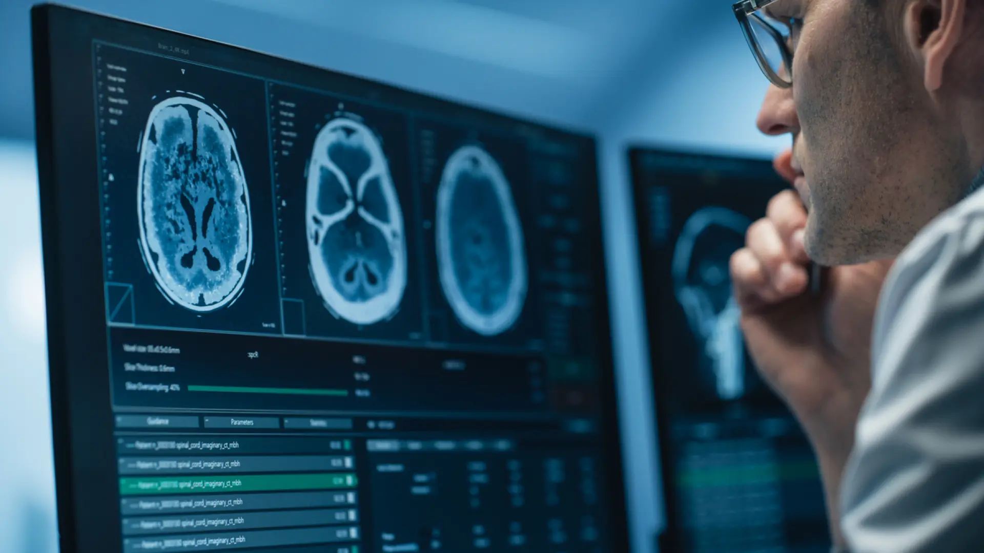 Un nuevo tratamiento logra controlar el tumor en el 96% de pacientes con un tipo de glioma cerebral Un nuevo tratamiento logra controlar el tumor en el 96% de pacientes con un tipo de glioma cerebral